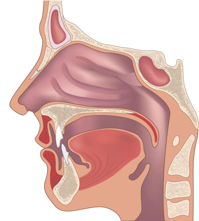 Airway Problems | Advanced Ear, Nose & Throat