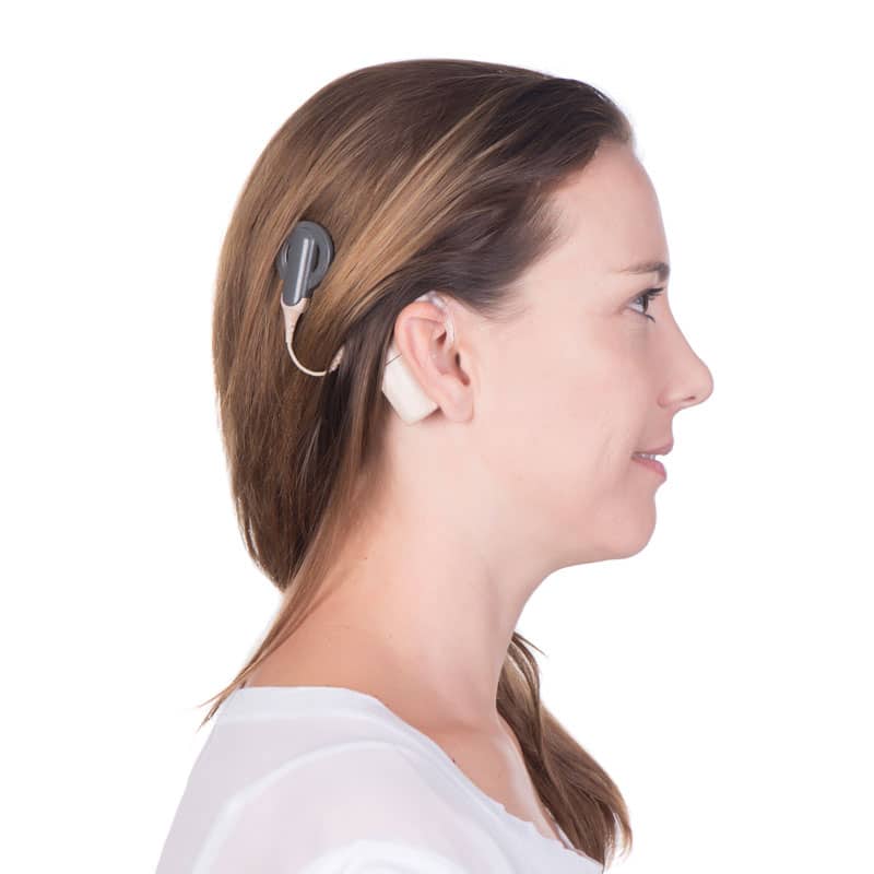 Cochlear Implants - Advanced Ear, Nose & Throat